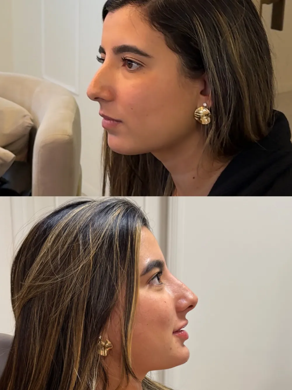 Caso 07: antes e depois, terceiro ângulo
