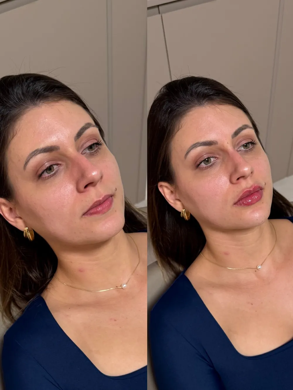 Caso 09: antes e depois, segundo ângulo